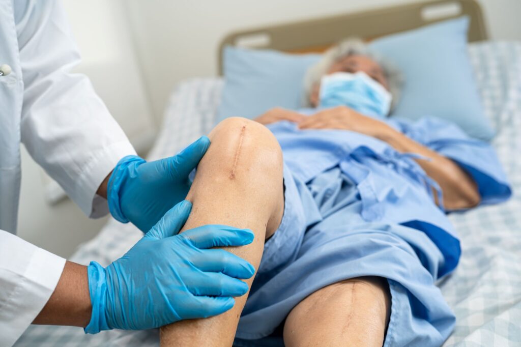 Ein Arzt untersucht die Beine eines Patienten auf Beinulkus.